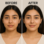 Instant Whitening Cream – Acne & Anti-Ageing Formula (Guaranteed Results)